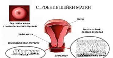 Uterine cancer: first signs and symptoms, early treatment